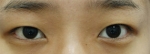 ABC Plastic Surgery,Reviews,Images, Promotions — Korea cost, reviews & before-after | MISOODA