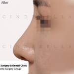 Cinderella Plastic Surgery,Reviews,Images,Promotions — Korea cost, reviews & before-after | MISOODA