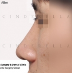 Cinderella Plastic Surgery,Reviews,Images,Promotions — Korea cost, reviews & before-after | MISOODA