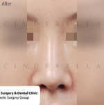 Cinderella Plastic Surgery,Reviews,Images,Promotions — Korea cost, reviews & before-after | MISOODA