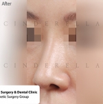 Cinderella Plastic Surgery,Reviews,Images,Promotions — Korea cost, reviews & before-after | MISOODA