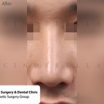 Cinderella Plastic Surgery,Reviews,Images,Promotions — Korea cost, reviews & before-after | MISOODA