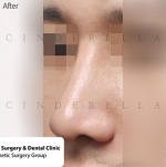 Cinderella Plastic Surgery,Reviews,Images,Promotions — Korea cost, reviews & before-after | MISOODA