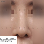 Cinderella Plastic Surgery,Reviews,Images,Promotions — Korea cost, reviews & before-after | MISOODA