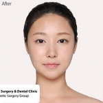 Cinderella Plastic Surgery,Reviews,Images,Promotions — Korea cost, reviews & before-after | MISOODA