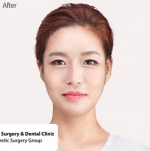 Cinderella Plastic Surgery,Reviews,Images,Promotions — Korea cost, reviews & before-after | MISOODA