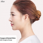 Cinderella Plastic Surgery,Reviews,Images,Promotions — Korea cost, reviews & before-after | MISOODA