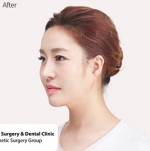 Cinderella Plastic Surgery,Reviews,Images,Promotions — Korea cost, reviews & before-after | MISOODA