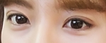 Hyundai Aesthetics, Reviews, Images, Promotions — Korea cost, reviews & before-after | MISOODA