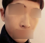 Hyundai Aesthetics, Reviews, Images, Promotions — Korea cost, reviews & before-after | MISOODA