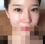 Hyundai Aesthetics, Reviews, Images, Promotions — Korea cost, reviews & before-after | MISOODA