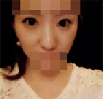 Hyundai Aesthetics, Reviews, Images, Promotions — Korea cost, reviews & before-after | MISOODA