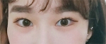 Hyundai Aesthetics, Reviews, Images, Promotions — Korea cost, reviews & before-after | MISOODA