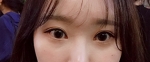 Hyundai Aesthetics, Reviews, Images, Promotions — Korea cost, reviews & before-after | MISOODA