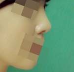 Hyundai Aesthetics, Reviews, Images, Promotions — Korea cost, reviews & before-after | MISOODA