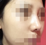Hyundai Aesthetics, Reviews, Images, Promotions — Korea cost, reviews & before-after | MISOODA