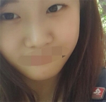 Hyundai Aesthetics, Reviews, Images, Promotions — Korea cost, reviews & before-after | MISOODA