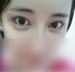 Hyundai Aesthetics, Reviews, Images, Promotions — Korea cost, reviews & before-after | MISOODA