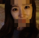 Hyundai Aesthetics, Reviews, Images, Promotions — Korea cost, reviews & before-after | MISOODA