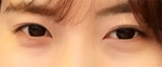 Hyundai Aesthetics, Reviews, Images, Promotions — Korea cost, reviews & before-after | MISOODA