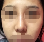 Hyundai Aesthetics, Reviews, Images, Promotions — Korea cost, reviews & before-after | MISOODA