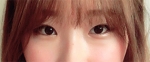 Hyundai Aesthetics, Reviews, Images, Promotions — Korea cost, reviews & before-after | MISOODA