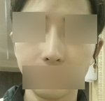 Hyundai Aesthetics, Reviews, Images, Promotions — Korea cost, reviews & before-after | MISOODA