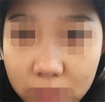 Hyundai Aesthetics, Reviews, Images, Promotions — Korea cost, reviews & before-after | MISOODA