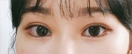 Hyundai Aesthetics, Reviews, Images, Promotions — Korea cost, reviews & before-after | MISOODA
