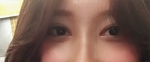 Hyundai Aesthetics, Reviews, Images, Promotions — Korea cost, reviews & before-after | MISOODA