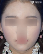 TOP FACE Plastic Surgery,Reviews,Images, Promotions — Korea cost, reviews & before-after | MISOODA