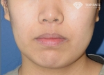 TOP FACE Plastic Surgery,Reviews,Images, Promotions — Korea cost, reviews & before-after | MISOODA