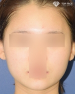 TOP FACE Plastic Surgery,Reviews,Images, Promotions — Korea cost, reviews & before-after | MISOODA
