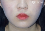 TOP FACE Plastic Surgery,Reviews,Images, Promotions — Korea cost, reviews & before-after | MISOODA