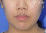 TOP FACE Plastic Surgery,Reviews,Images, Promotions — Korea cost, reviews & before-after | MISOODA