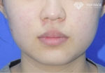 TOP FACE Plastic Surgery,Reviews,Images, Promotions — Korea cost, reviews & before-after | MISOODA