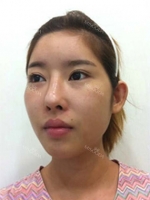 GIRIN Plastic Surgery. GIRIN aesthetic Clinic — Korea cost, reviews & before-after | MISOODA