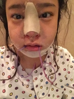 Cinderella Plastic Surgery,Reviews,Images,Promotions — Korea cost, reviews & before-after | MISOODA