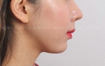 facial bone