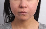 Ruby Plastic Surgery, Reviews, Images, Promotions — Korea cost, reviews & before-after | MISOODA