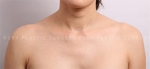 Ruby Plastic Surgery, Reviews, Images, Promotions — Korea cost, reviews & before-after | MISOODA
