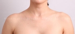 Ruby Plastic Surgery, Reviews, Images, Promotions — Korea cost, reviews & before-after | MISOODA