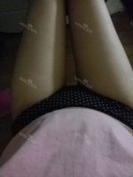 Thighs liposuction 1