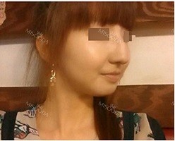 Misooda — Korea cost, reviews & before-after | MISOODA