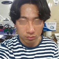 Misooda — Korea cost, reviews & before-after | MISOODA