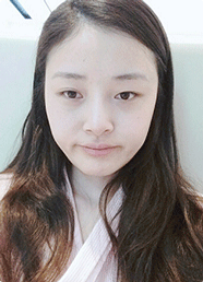 Eyelid Revision — Korea cost, reviews & before-after | MISOODA