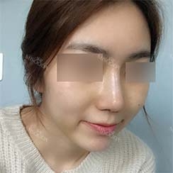 Misooda — Korea cost, reviews & before-after | MISOODA