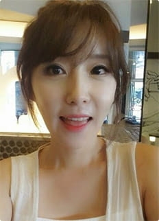 Jaw + Eyelid Revision, Accusculpt, Fat Graft — Korea cost, reviews & before-after | MISOODA