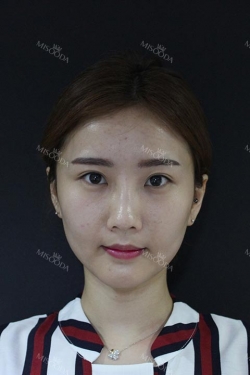 Misooda — Korea cost, reviews & before-after | MISOODA