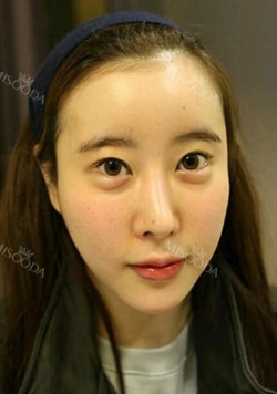 Misooda — Korea cost, reviews & before-after | MISOODA